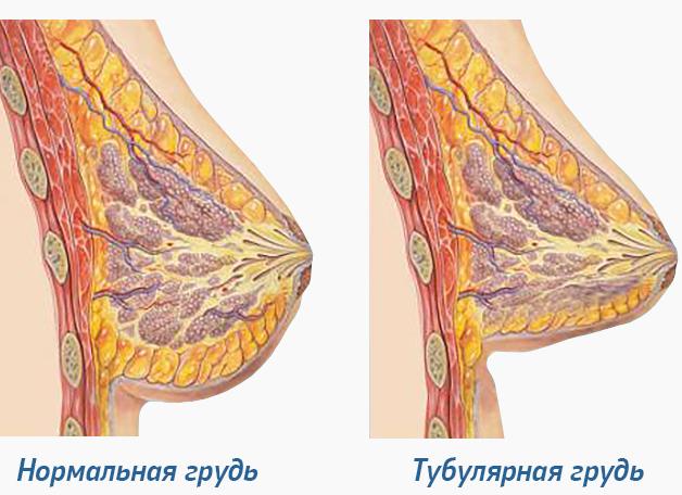Почему грудь маленькая и не растет?